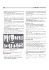NCERT Notes Indian History (Class 6-12) | 2nd Revised Edition | For UPSC and Other Competitive Exams | Hindi Medium